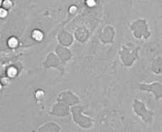 Monocyte adhesion to endothelium